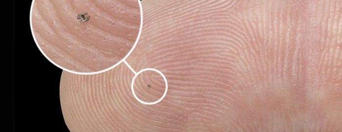 Implant cochléaire découpé par électro-érosion à fil réalisé la société VUICHARD SAS.