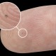 Implant cochléaire découpé par électro-érosion à fil réalisé la société VUICHARD SAS.